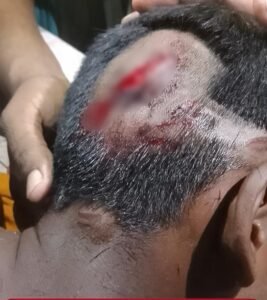 शिवपुर में आदमखोर बाघ ने बच्चा किया घायल