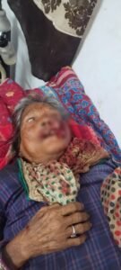 खूंखार जानवर के हमले से बुजुर्ग महिला गंभीर दहशत में ग्रामीण