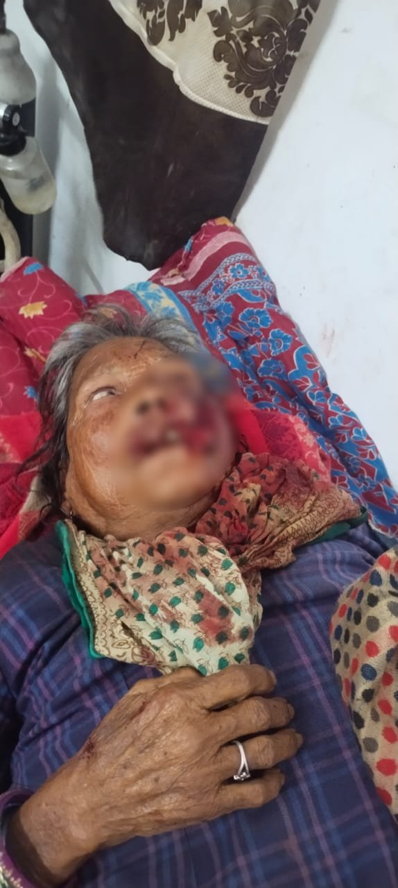 खूंखार जानवर के हमले से बुजुर्ग महिला गंभीर दहशत में ग्रामीण
