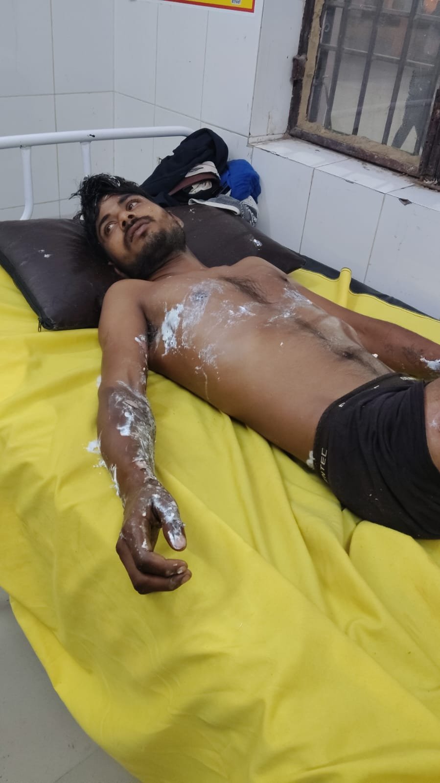 High Voltage Accident